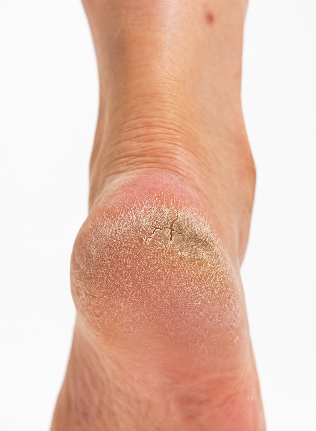 CRESILIA INSTANT FOOT PEELING THE DELUXE  KIT